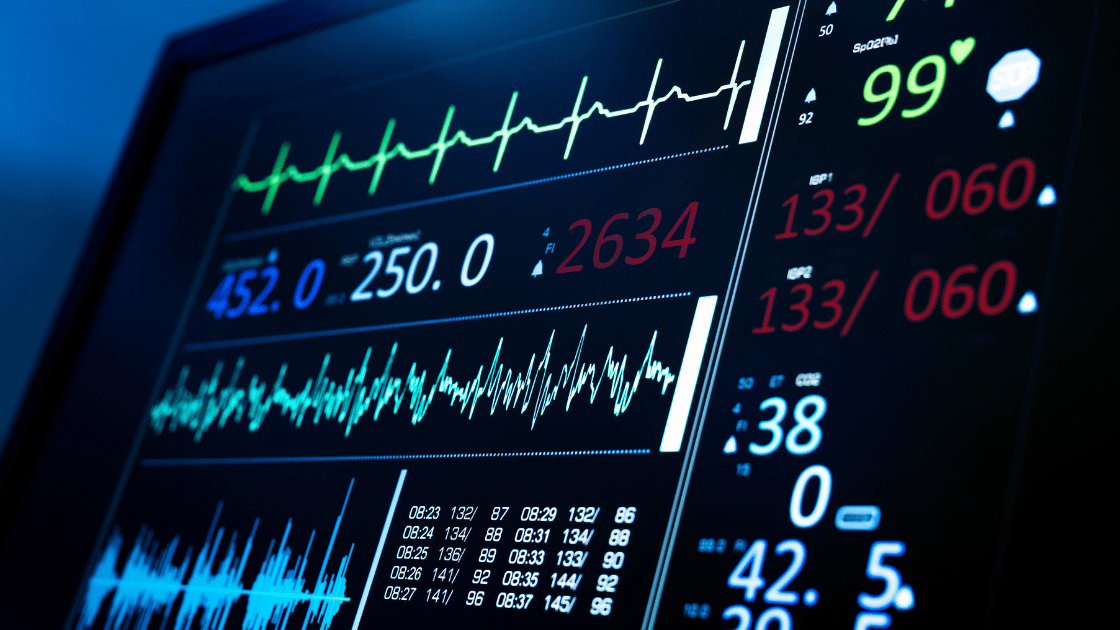 ECG machine monitor showing heart rate and rhythm patterns during cardiac screening at medical center