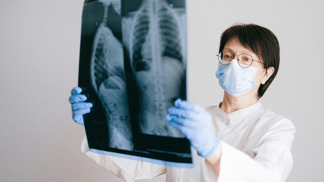 Professional nurse at HOP Medical Centre examining chest x-ray film for abnormalities during routine health screening in Singapore