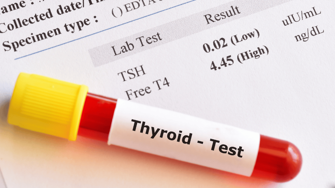 Blood test tubes for health screening Singapore measuring thyroid function insulin resistance metabolic markers