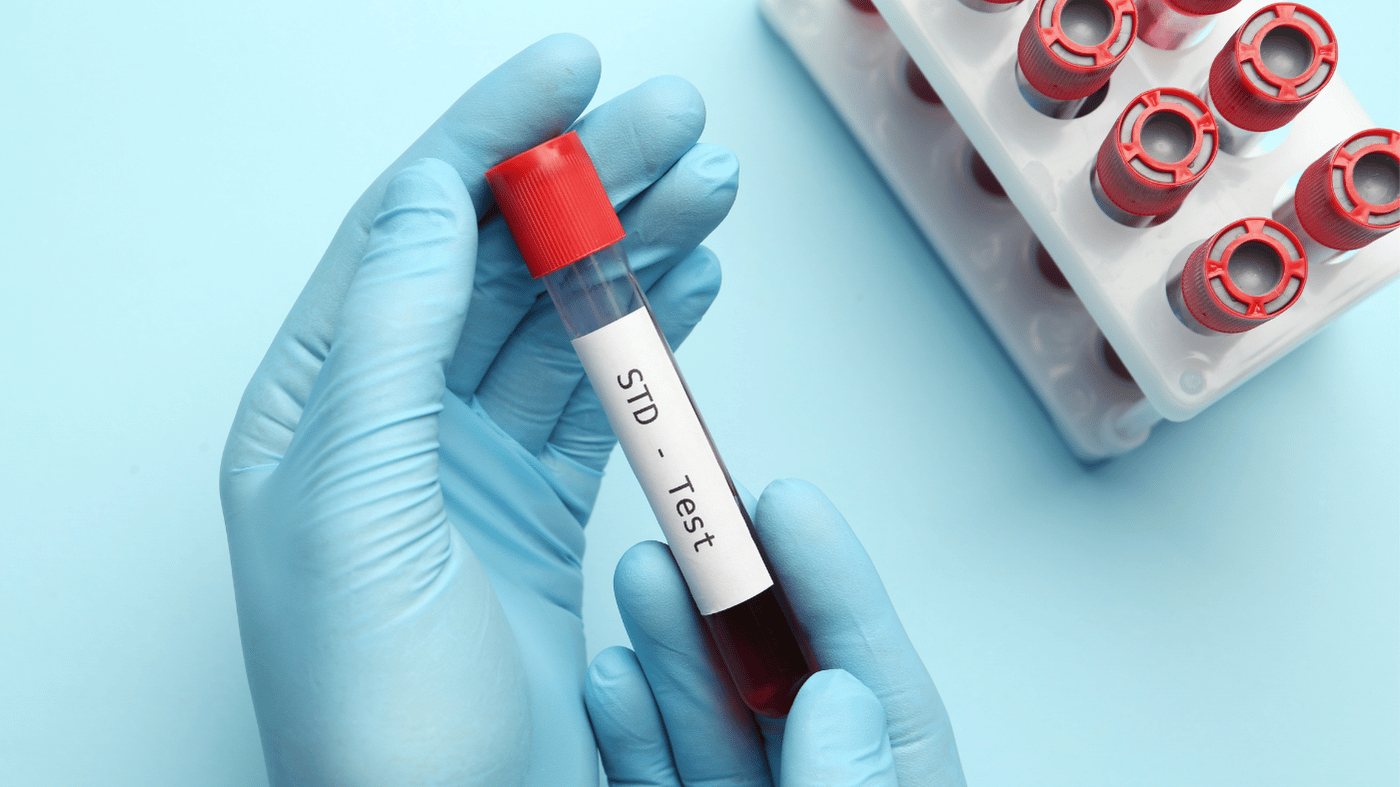 Nurse holding an STD test blood sample tube at HOP Medical Centre Singapore