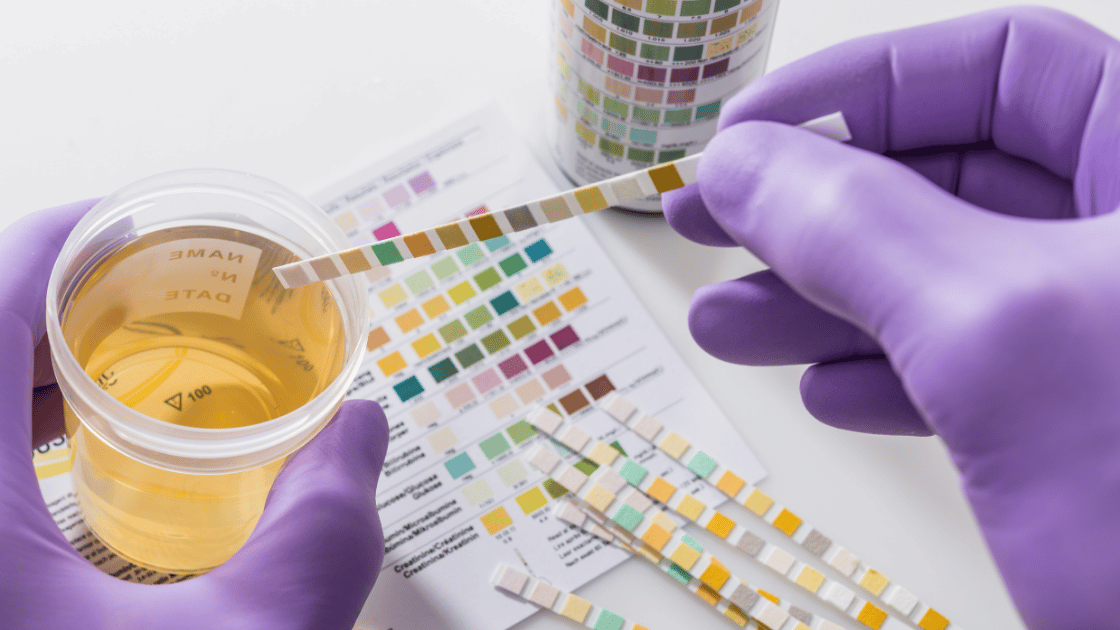 Clinical team reviewing urine test results during a health screening appointment at HOP Medical Centre Singapore