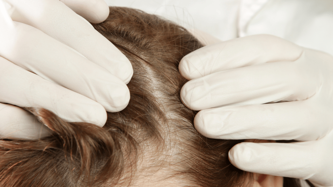 Woman discussing female hair loss treatment options with a doctor at HOP Medical Centre Singapore