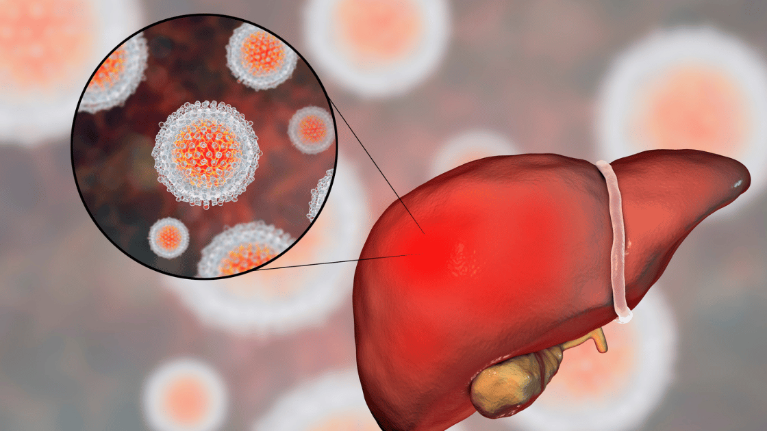 3D illustration of hepatitis virus particles and the liver, representing Hepatitis B and C as sexually transmitted infections at HOP Medical Centre