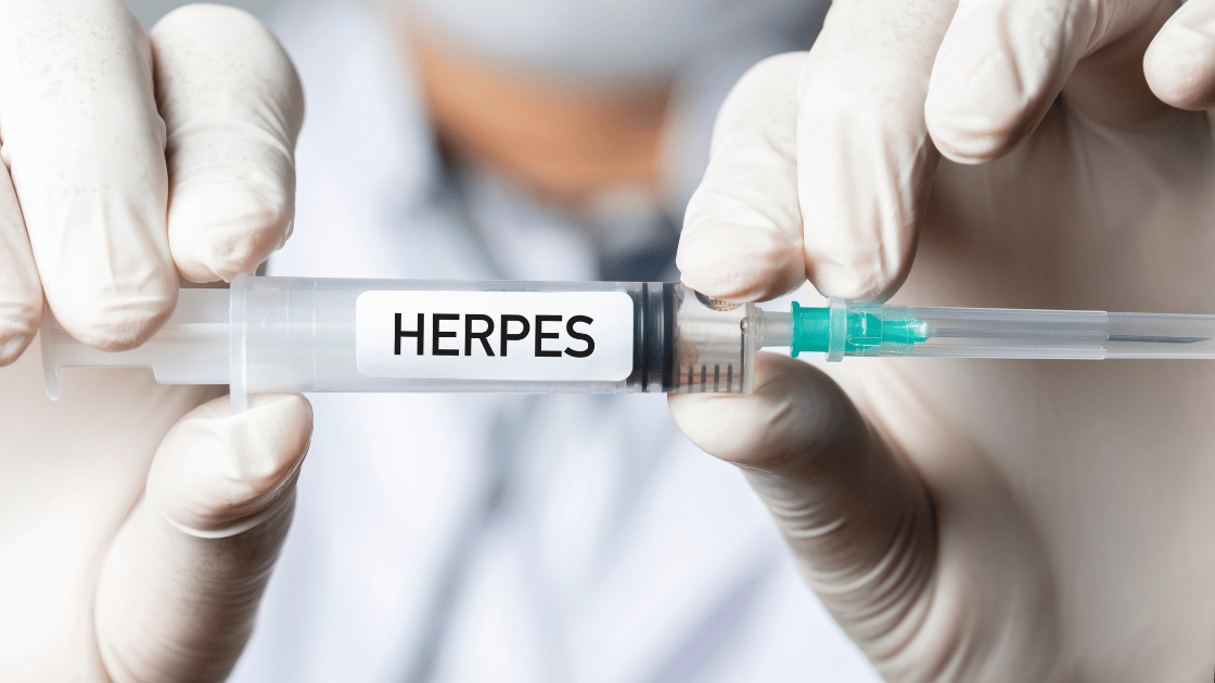 Illustration representing herpes symptoms awareness and testing at HOP Medical Centre Singapore