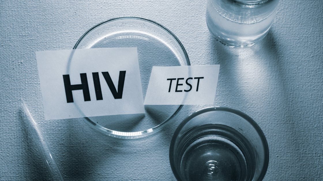 HIV test label in a petri dish, representing undetectable equals untransmittable and HIV testing at HOP Medical Centre